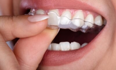 Clear Aligner Safety